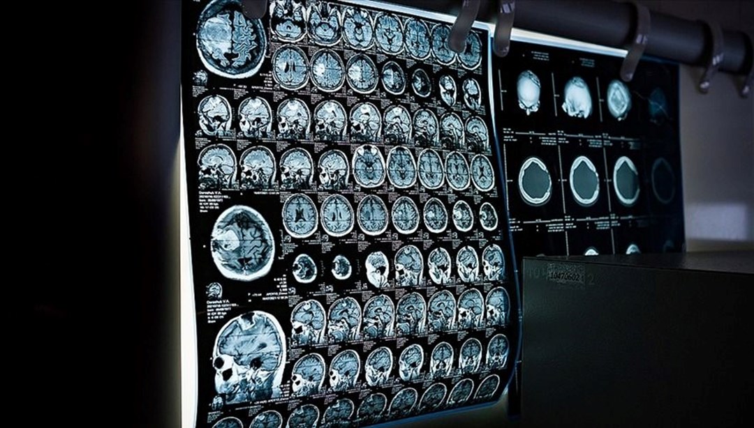 İstanbul’da 81 bini aşkın kişiye ücretsiz kanser taraması – Son Dakika Türkiye Haberleri