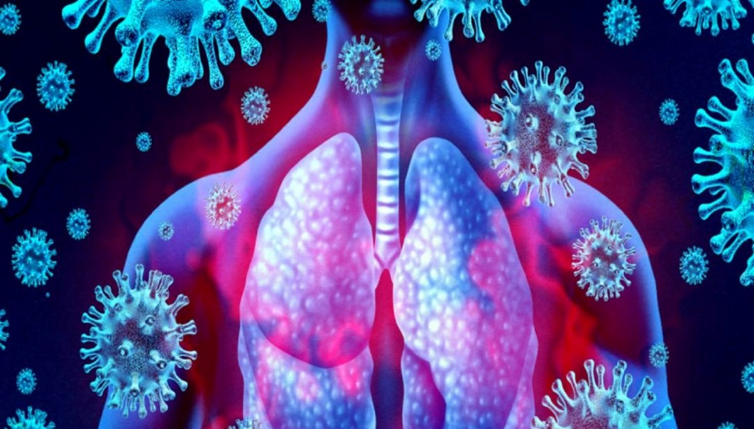 Latin Amerika’da salgın endişesi: Oropouche Virüsü nedir, belirtileri neler?