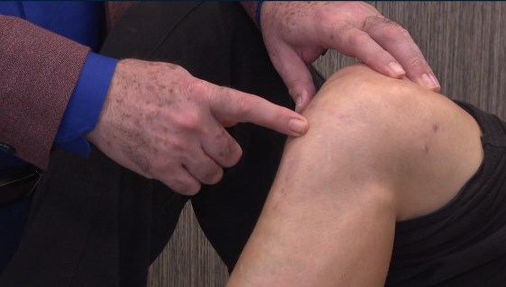 Sakatlığı hızlı iyileştiren taktik! Türk doktor tıp literatürüne girdi