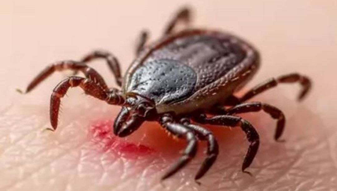 Kene ısırmasında sakın bunu yapmayın: Yüzde 100 bulaş sağlıyor – Son Dakika Türkiye Haberleri