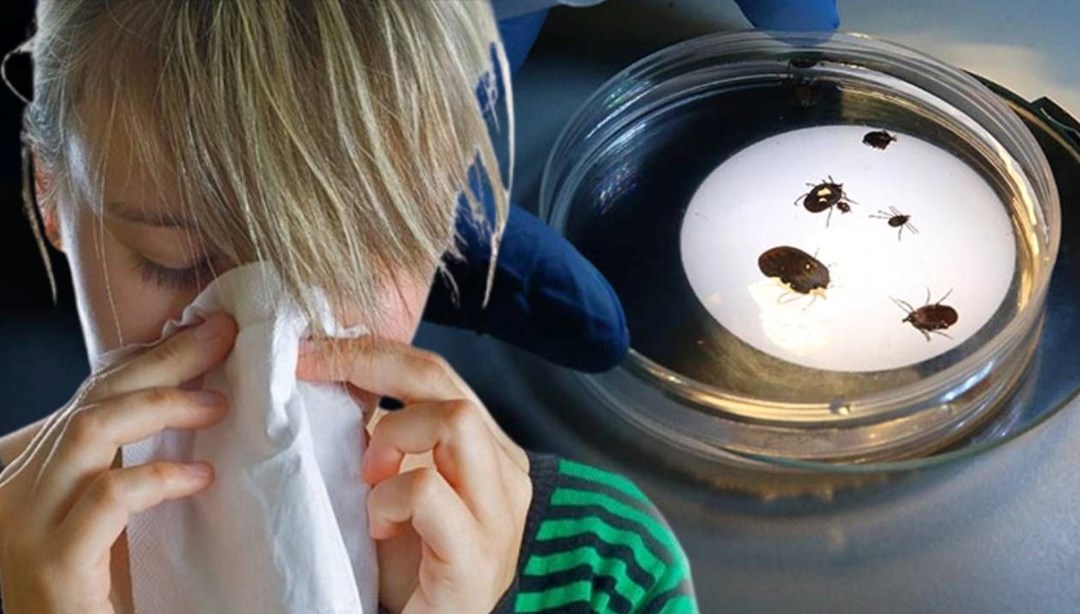 Kırım Kongo Kanamalı Ateşi ile grip nasıl ayırt edilir? Uzmanı açıkladı