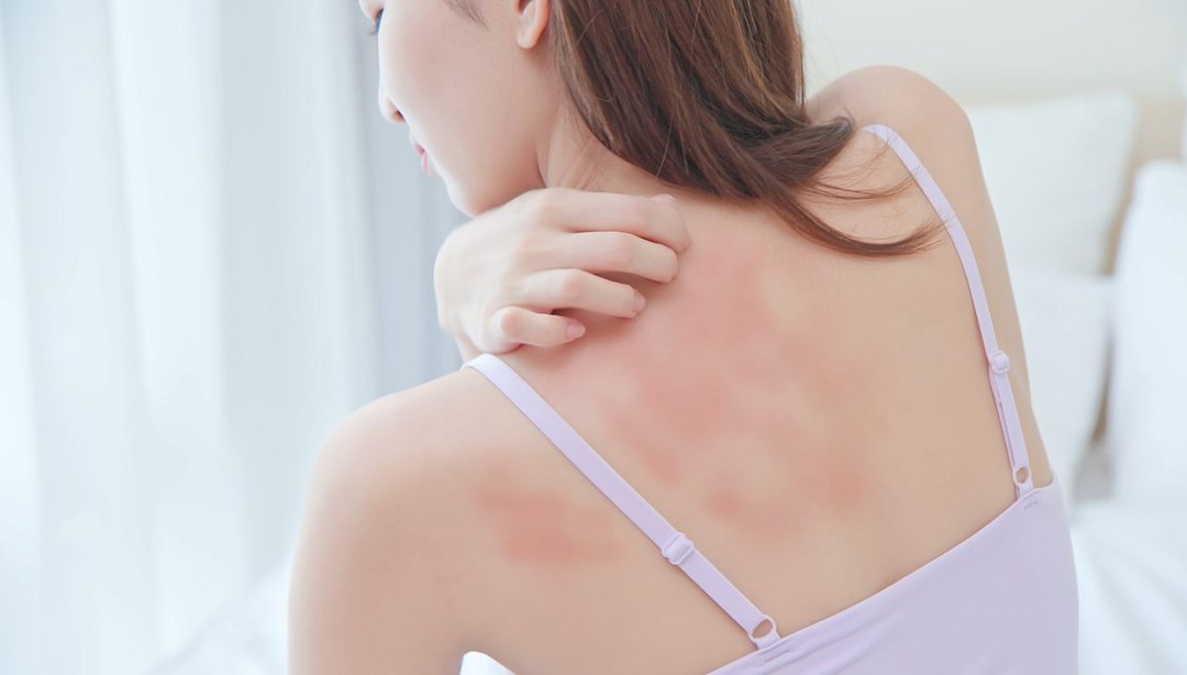 Karaciğerin bozulduğunu gösteren 7 işaret: Sessizce başlıyor