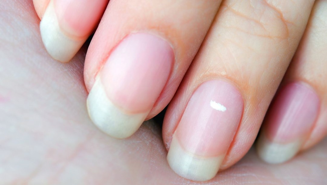 Tırnaklarınızı hemen kontrol edin: Kalp ve karaciğer hastalığının sinyali