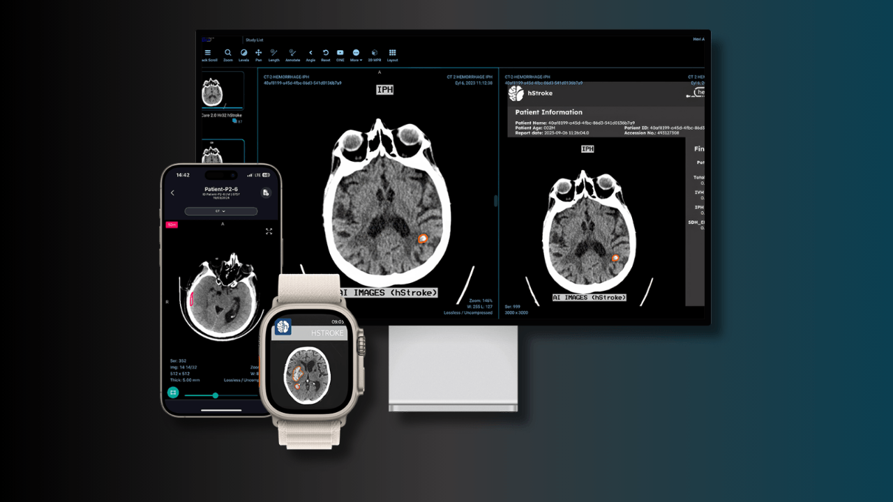 Yerli yapay zeka radyoloji girişimi: Hevi AI