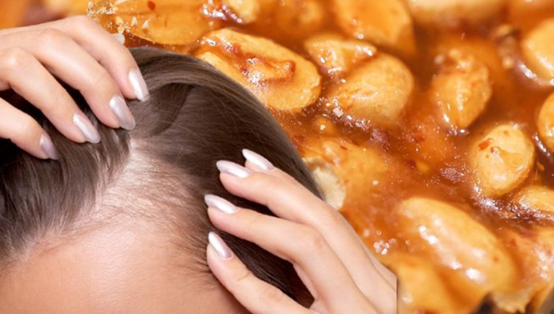 Uzmanı uyarıyor: Bu besin saç dökülmesini hızlandırıyor – Son Dakika Yaşam Haberleri