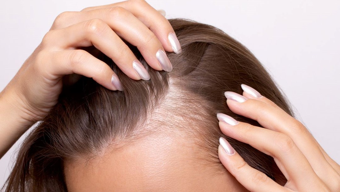 Dermatolog açıkladı: Mevsimsel saç dökülmesi neden oluyor?