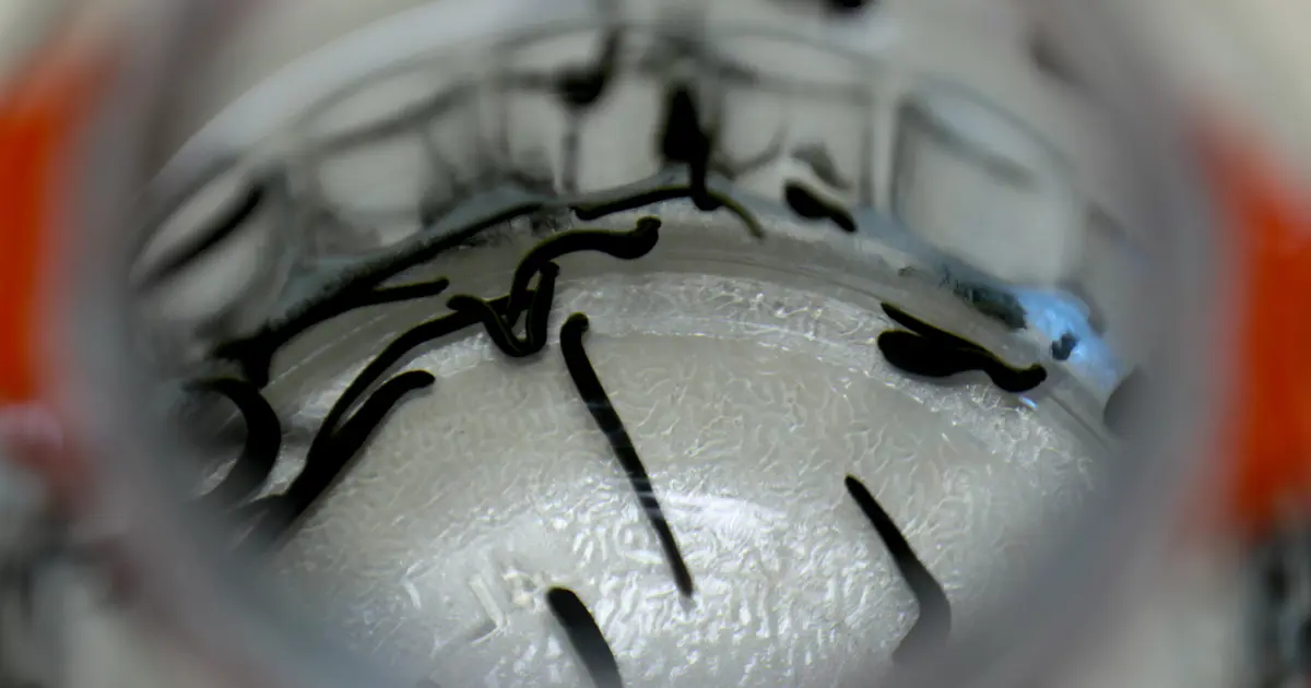 Hacamat, sülük, akupunktur… Bakanlık bünyesinde enstitü kuruldu, geleneksel tıp geliştirilecek