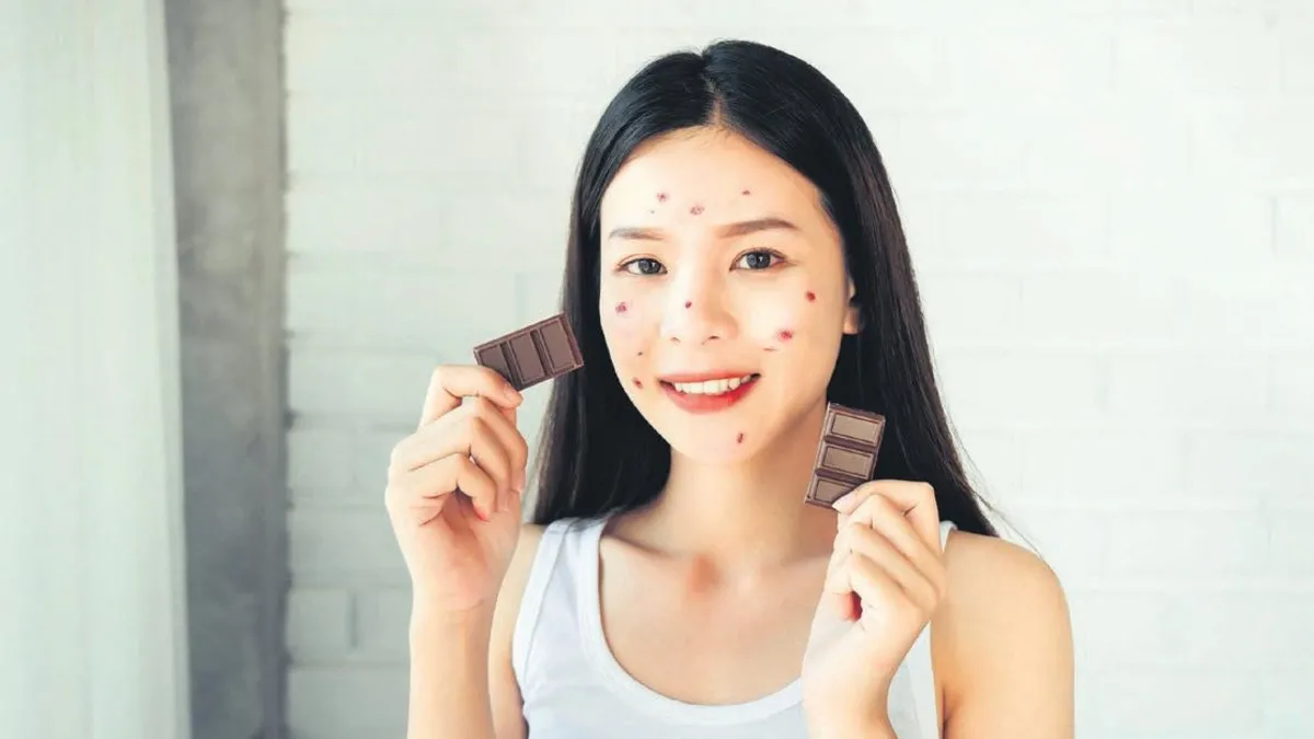 Çikolata ve Sivilce İlişkisi: Gerçekler ve Mitler