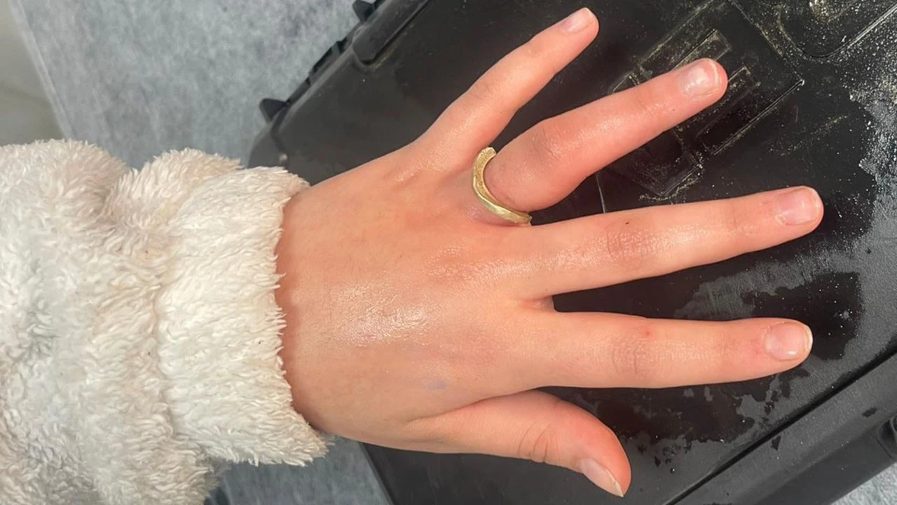 İtfaiye Ekipleri Acil Yüzük Kurtarma Operasyonu Gerçekleştirdi