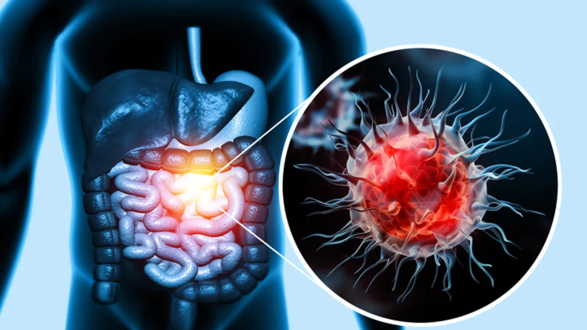 Kanserden Korunmanın Yolu Sağlıklı Alışkanlıklardan Geçiyor