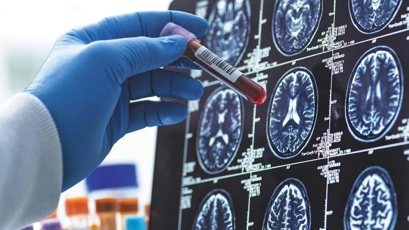 Yeni Kan Testi Alzheimer’ı Yıllar Öncesinden Öngörebilir