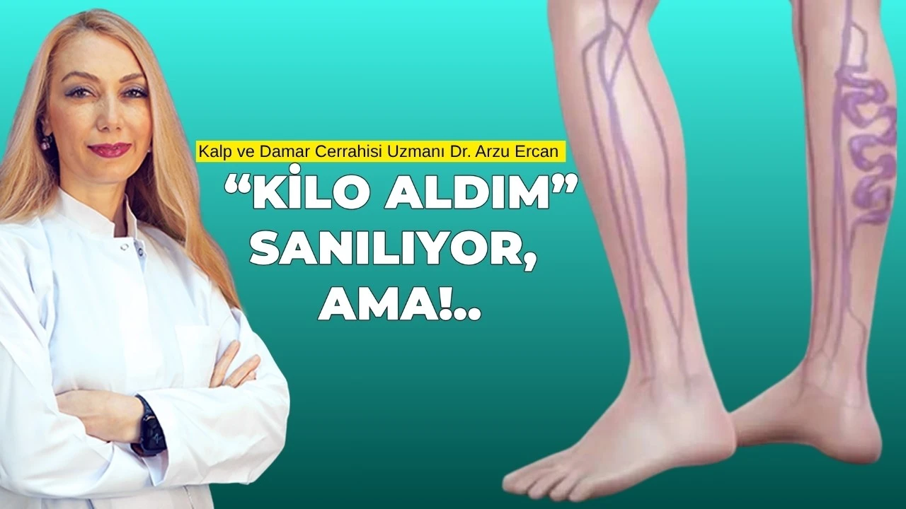 Bacaklarda Şişlik ve Ağrıya Dikkat: Ciddiye Alınması Gereken İşaretler