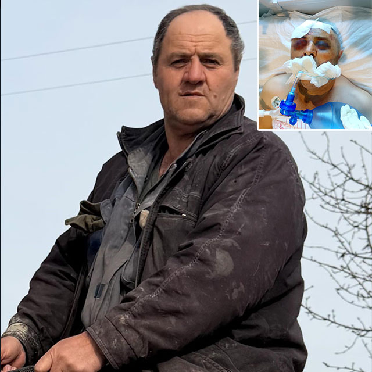 Köpek Kavgasında Baba ve Oğulun Şiddeti Sonuçlandı