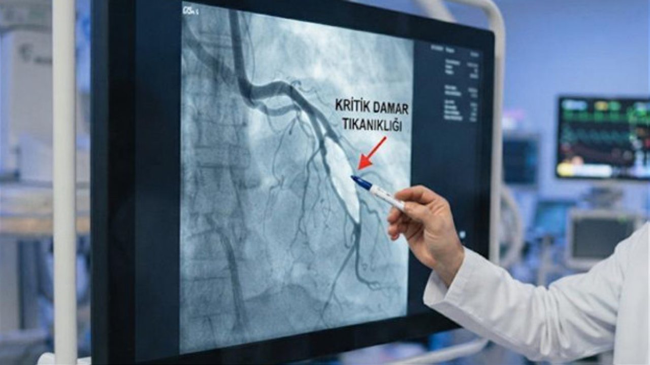 Türkiye’de ölümlerin yüzde 34,7’si kalp ve damar hastalıklarından kaynaklanıyor