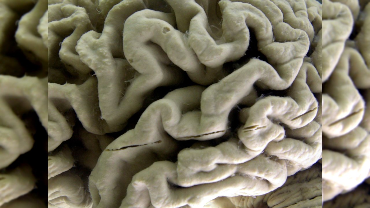 Kan Testi Alzheimer Riskini Belirlemeye Yardımcı Olabilir