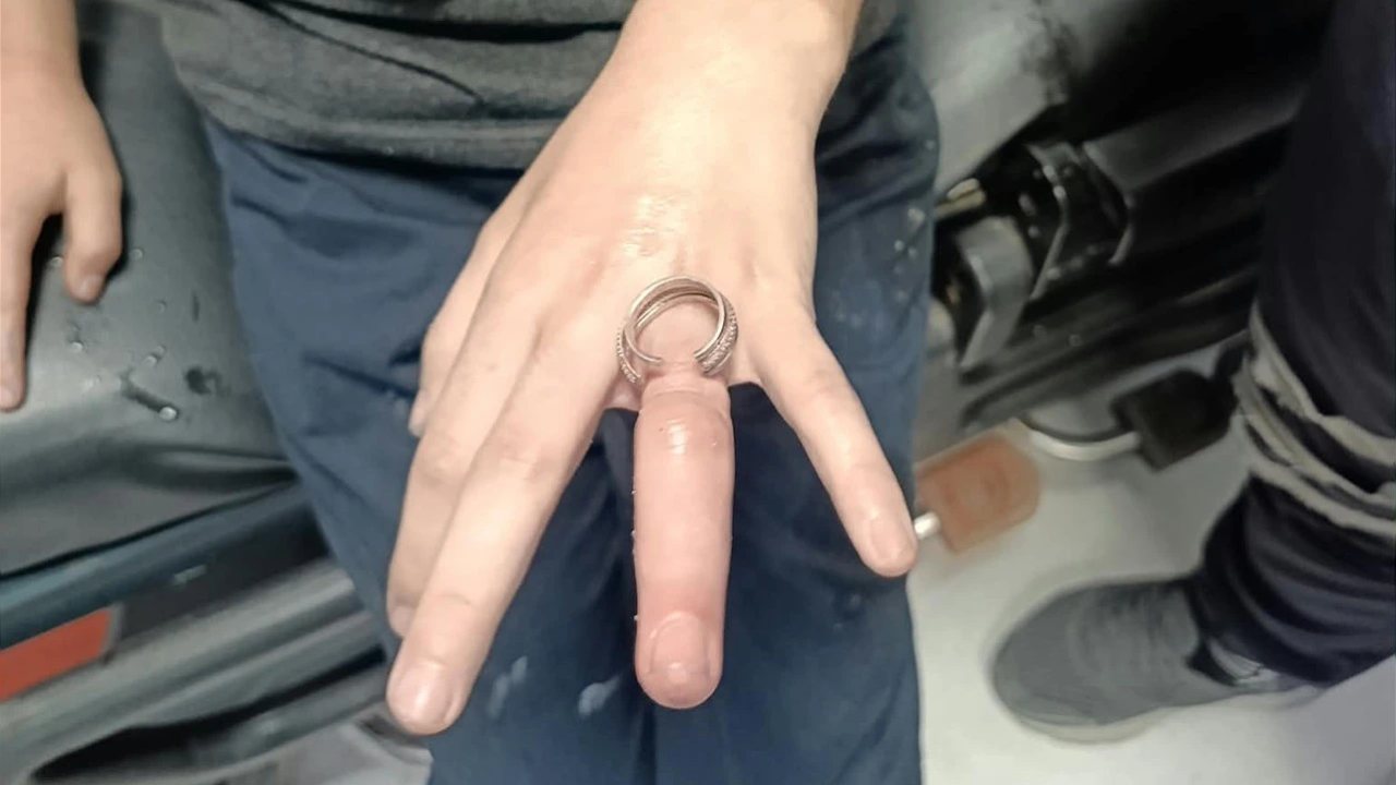Batman’da Yüzük Sıkışması İtfaiye ile Çözüldü