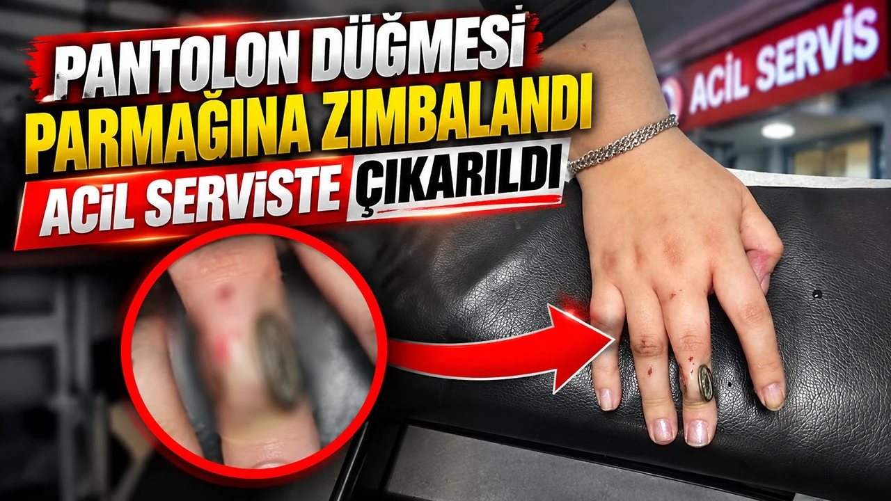 Batman’da Pantolon Düğmesi Parmağına Saplandı
