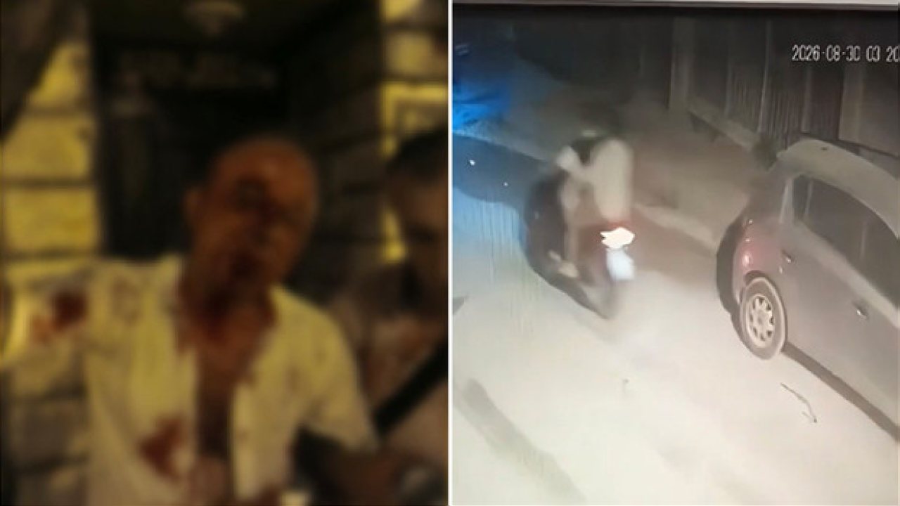 İstanbul’da Alkollü Kavgada Bir Kişi Yaralandı