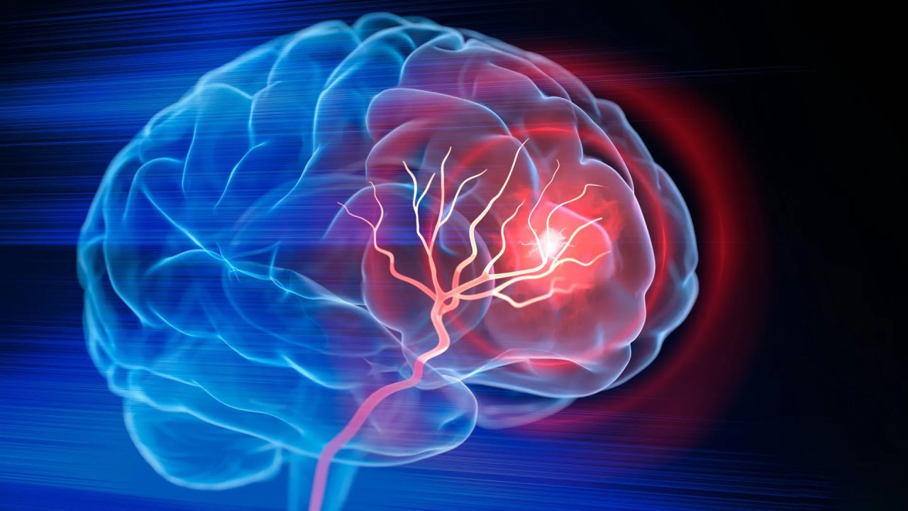 Alzheimer Riski Taşıyan APOE4 Geninin Zayıflığı Giderilebilir
