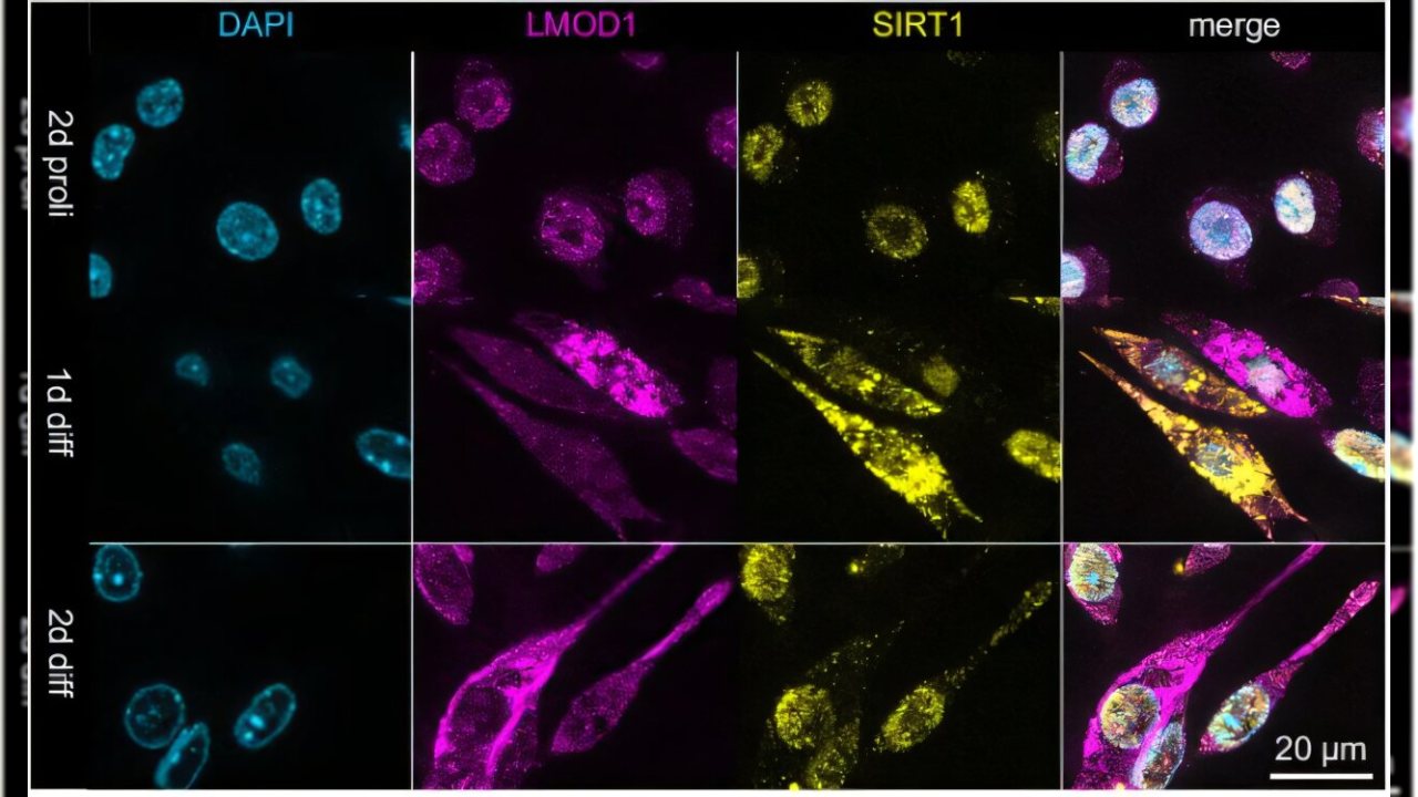 Kas Yenilenmesinde LMOD1 Proteininin Rolü Araştırılıyor