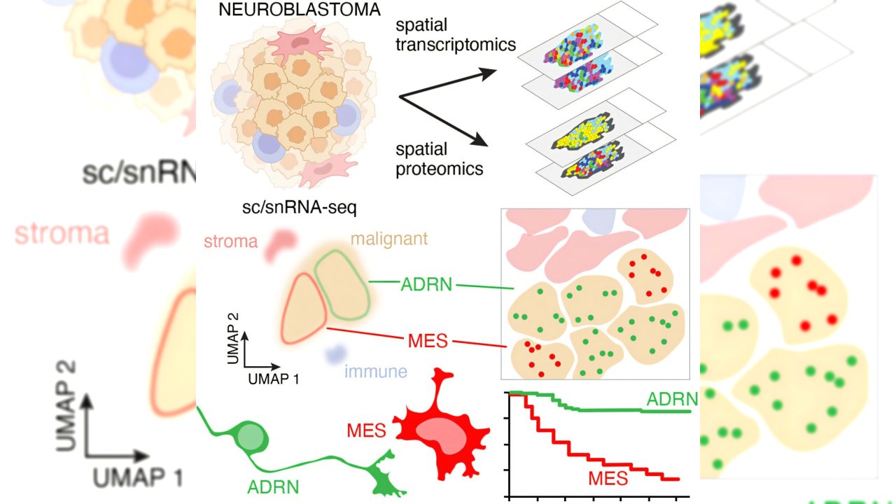 Neuroblastoma Hücreleri İyi Sonuçları Belirliyor