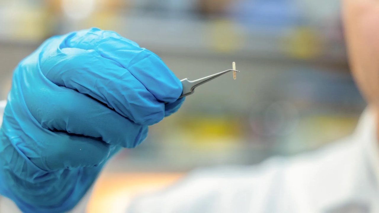 Küçük Cihaz Kronik Ağrıyı Kontrol Etme Potansiyeline Sahip