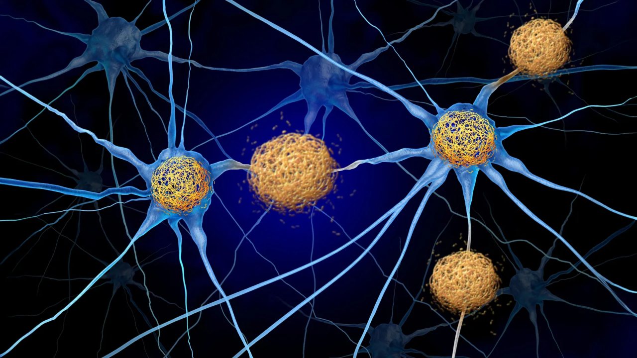 Alzheimer Hastalığında P3 Peptidi Üzerine Yeni Araştırma