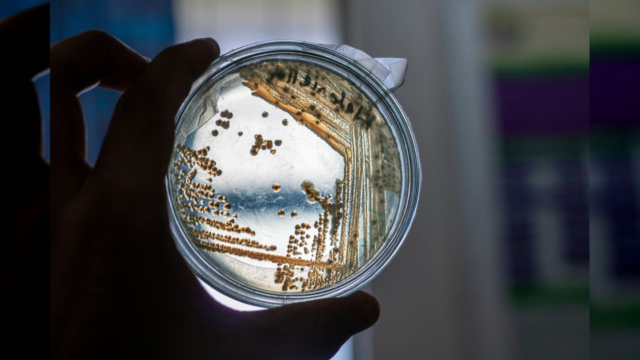 Güney Afrika’daki Kliniğe Yerleşen ESKAPE Bakterileri Antibiyotiklere Karşı Dayanıklı